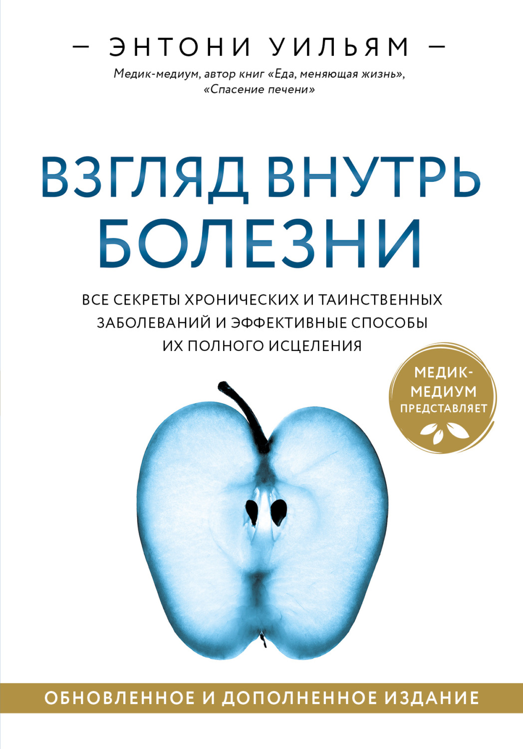 Взгляд внутрь болезни. Все секреты хронических и таинственных заболеваний и эффективные способы их полного исцеления